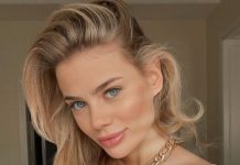 Невестка Орбакайте сделала уколы красоты и сняла процесс на видео