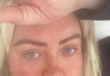 Родная мать перестала узнавать популярную модель из-за ботокса