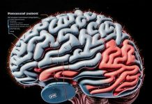 Для чего делают МРТ головы?