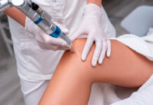 Послеоперационные шрамы – как предотвратить образование и минимизировать их видимость?