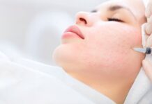 Фотостарение кожи: как справиться с этой неприятной проблемой?