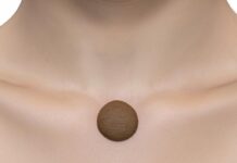 Когда стоит проверить родинку на онкологию?