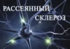 Можно ли вылечить рассеянный склероз: современные подходы и возможности